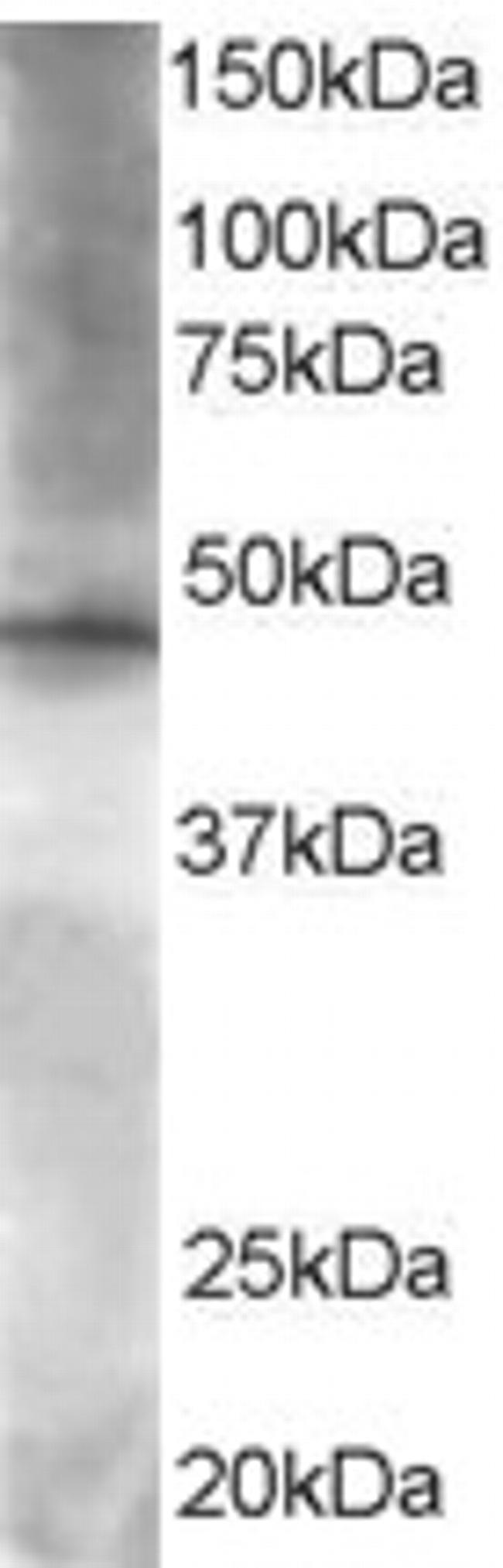 BRF2 Antibody in Western Blot (WB)