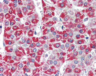 ACADM Antibody in Immunohistochemistry (Paraffin) (IHC (P))