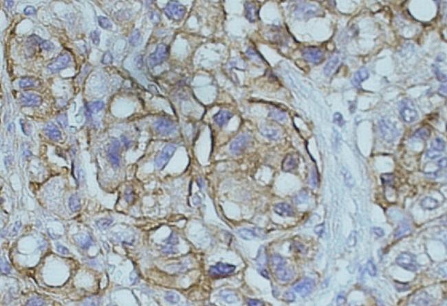 NDRG1 Antibody in Immunohistochemistry (Paraffin) (IHC (P))