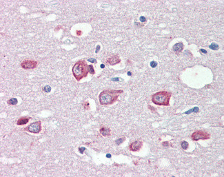 MLL4 Antibody in Immunohistochemistry (Paraffin) (IHC (P))