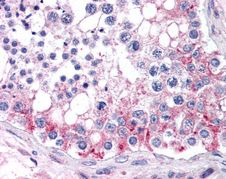 ABCB9 Antibody in Immunohistochemistry (Paraffin) (IHC (P))