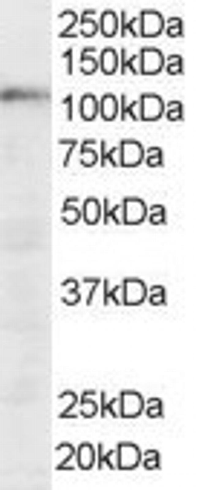 SART1 Antibody in Western Blot (WB)