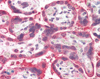 NEIL1 Antibody in Immunohistochemistry (Paraffin) (IHC (P))