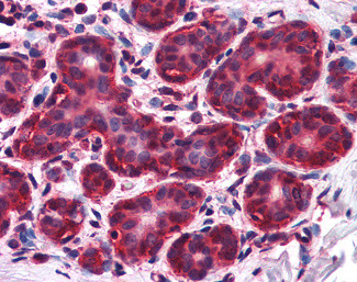 ALS2CR1 Antibody in Immunohistochemistry (Paraffin) (IHC (P))