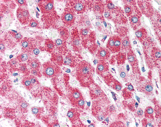 CLPP Antibody in Immunohistochemistry (Paraffin) (IHC (P))