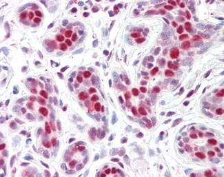 PHAPI2 Antibody in Immunohistochemistry (Paraffin) (IHC (P))