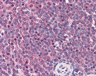 CARD11 Antibody in Immunohistochemistry (Paraffin) (IHC (P))