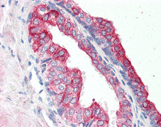 RNF34 Antibody in Immunohistochemistry (Paraffin) (IHC (P))