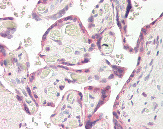 RNF139 Antibody in Immunohistochemistry (Paraffin) (IHC (P))