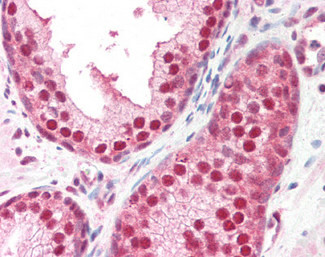 GPS1 Antibody in Immunohistochemistry (Paraffin) (IHC (P))