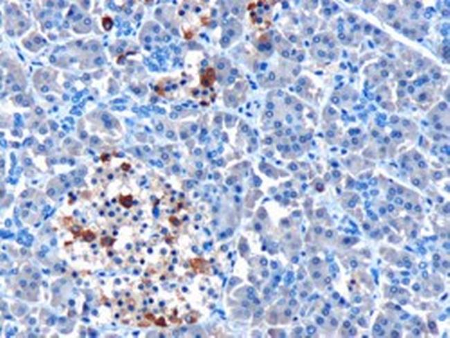 MDA5 Antibody in Immunohistochemistry (Paraffin) (IHC (P))