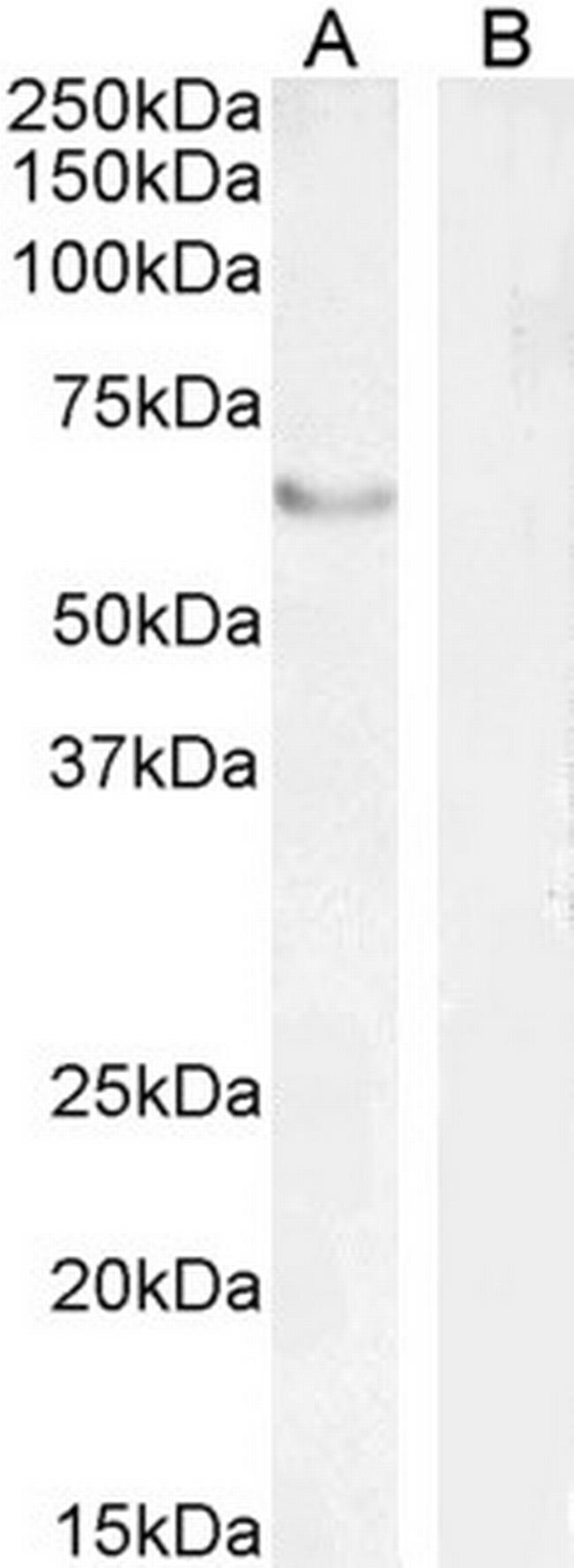 FOXC2 Antibody in Western Blot (WB)