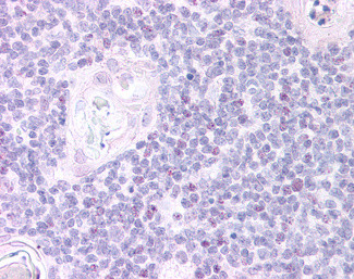 FOXN1 Antibody in Immunohistochemistry (Paraffin) (IHC (P))