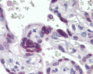 MRG15 Antibody in Immunohistochemistry (Paraffin) (IHC (P))