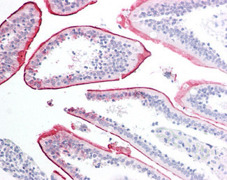 VPS45 Antibody in Immunohistochemistry (Paraffin) (IHC (P))