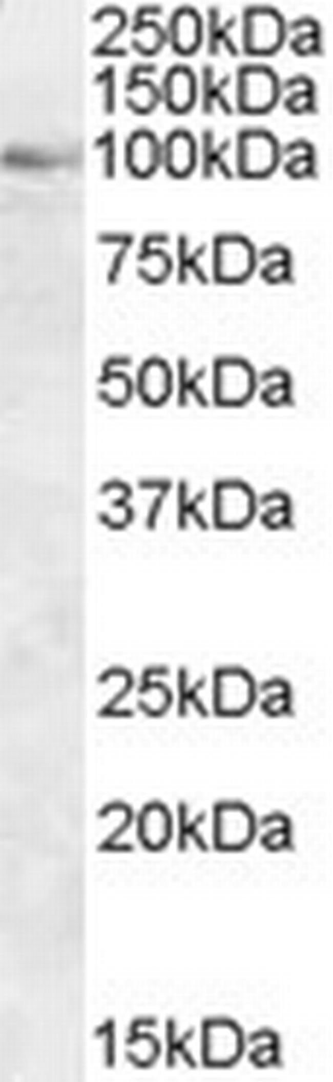 OSBP Antibody in Western Blot (WB)