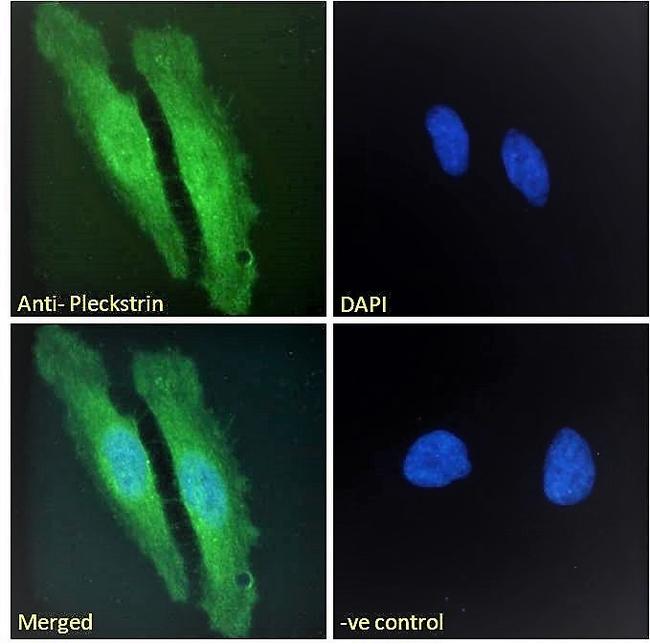 Pleckstrin Antibody in Immunocytochemistry (ICC/IF)