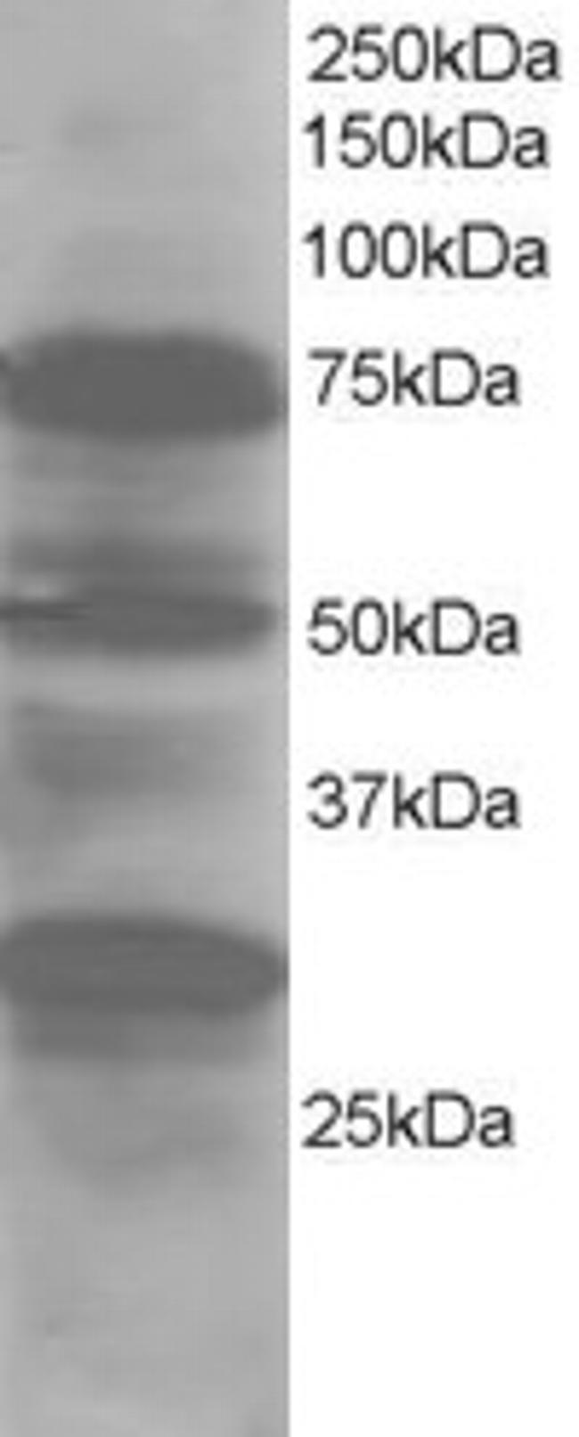 LMO7 Antibody in Western Blot (WB)