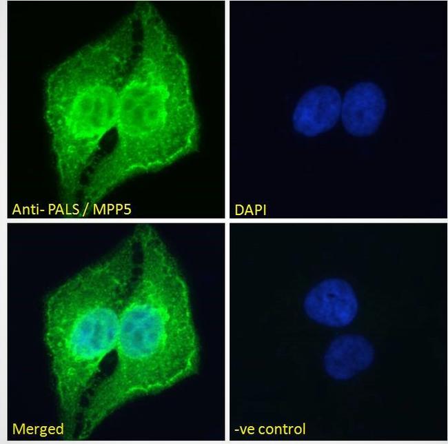 MPP5 Antibody in Immunocytochemistry (ICC/IF)