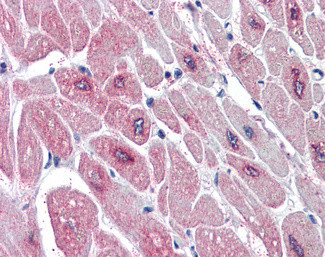 PAR6 Antibody in Immunohistochemistry (Paraffin) (IHC (P))