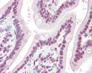 KPNA4 Antibody in Immunohistochemistry (Paraffin) (IHC (P))