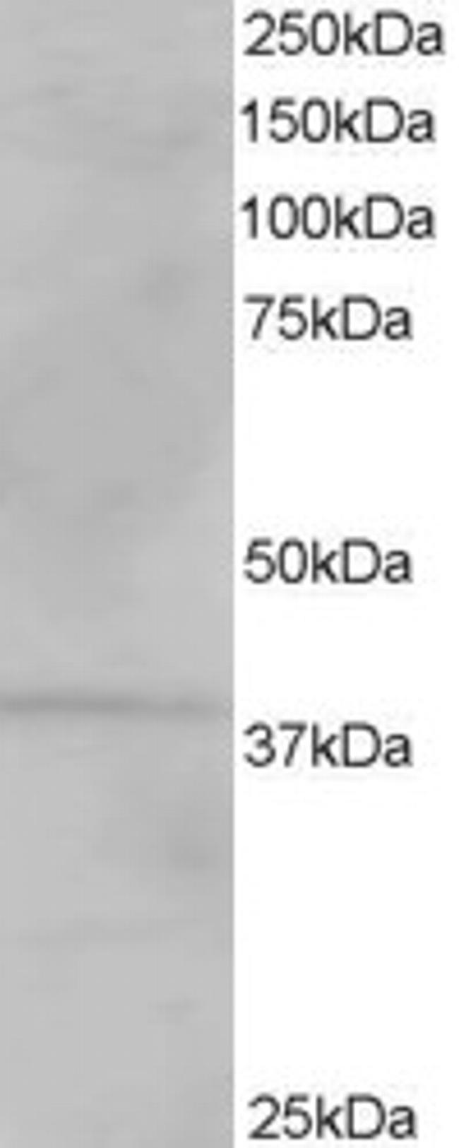 VPS26A Antibody in Western Blot (WB)