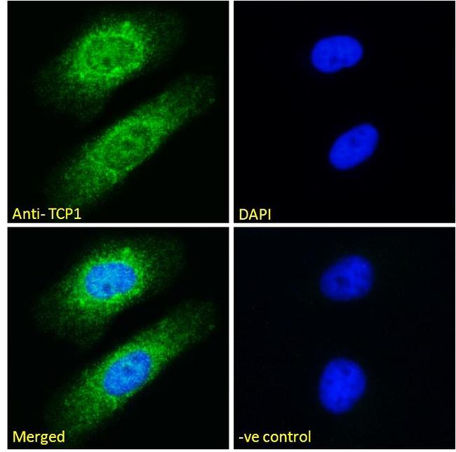 TCP1 Antibody in Immunocytochemistry (ICC/IF)