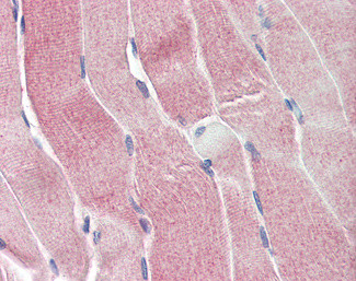 SIRT4 Antibody in Immunohistochemistry (Paraffin) (IHC (P))