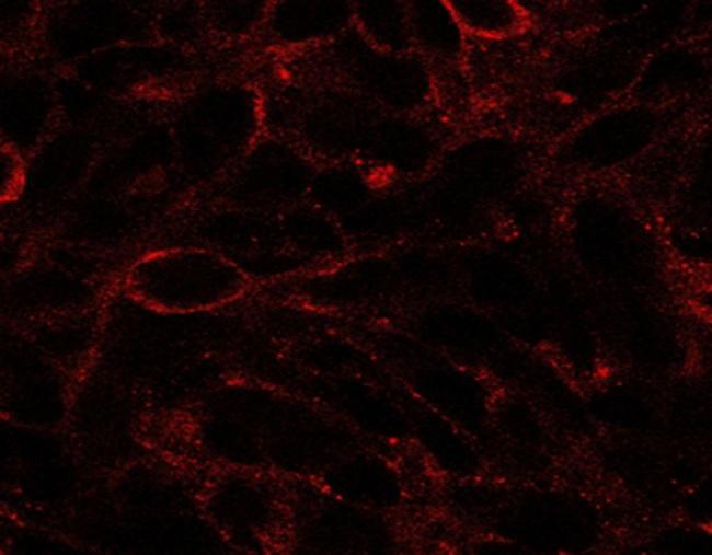 DISP1 Antibody in Immunocytochemistry (ICC/IF)