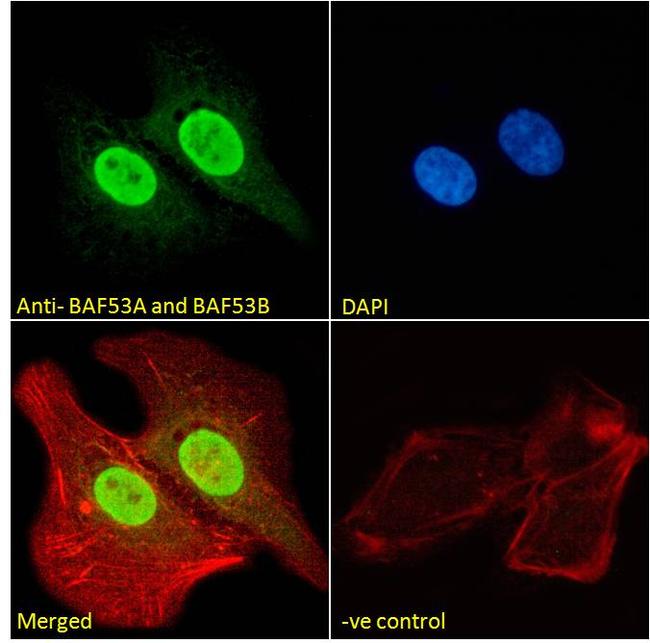 BAF53A/BAF53B Antibody in Immunocytochemistry (ICC/IF)