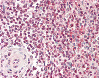 Pirin Antibody in Immunohistochemistry (Paraffin) (IHC (P))