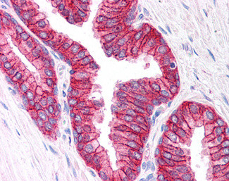 MRP4 Antibody in Immunohistochemistry (Paraffin) (IHC (P))