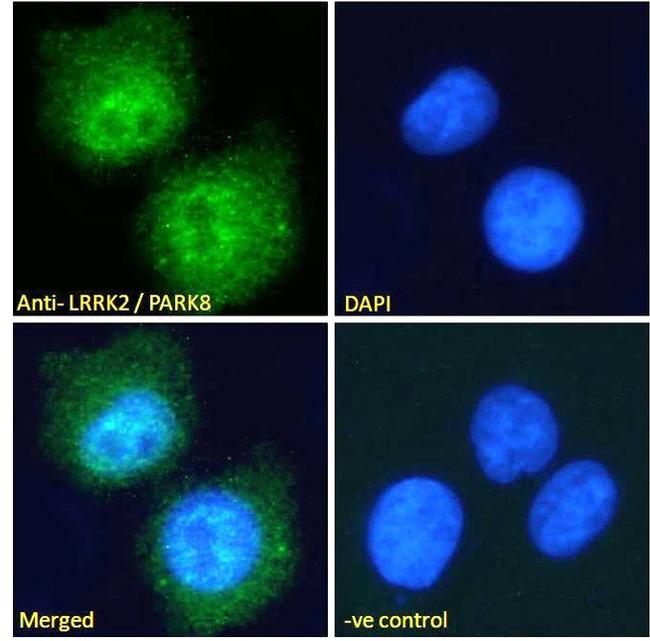 LRRK2 Antibody in Immunocytochemistry (ICC/IF)