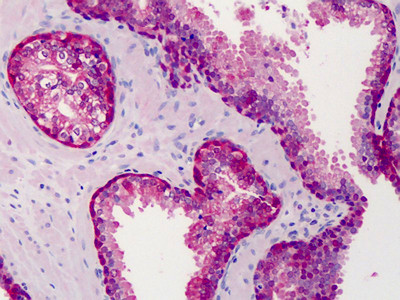 COMT Antibody in Immunohistochemistry (Paraffin) (IHC (P))