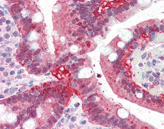 AKR1C3 Antibody in Immunohistochemistry (Paraffin) (IHC (P))