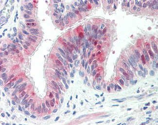 ZDHHC13 Antibody in Immunohistochemistry (Paraffin) (IHC (P))