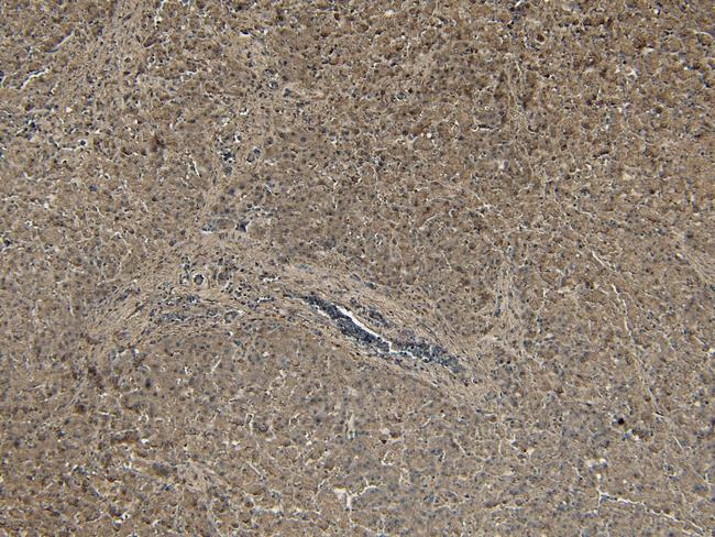 PCSK9 Antibody in Immunohistochemistry (Paraffin) (IHC (P))