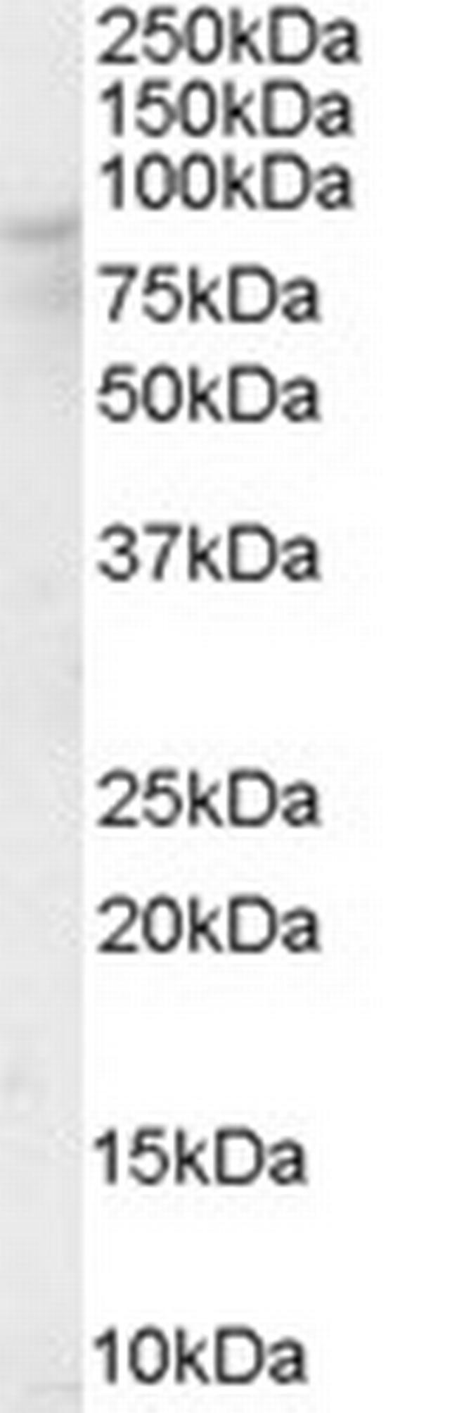 OSBP Antibody in Western Blot (WB)