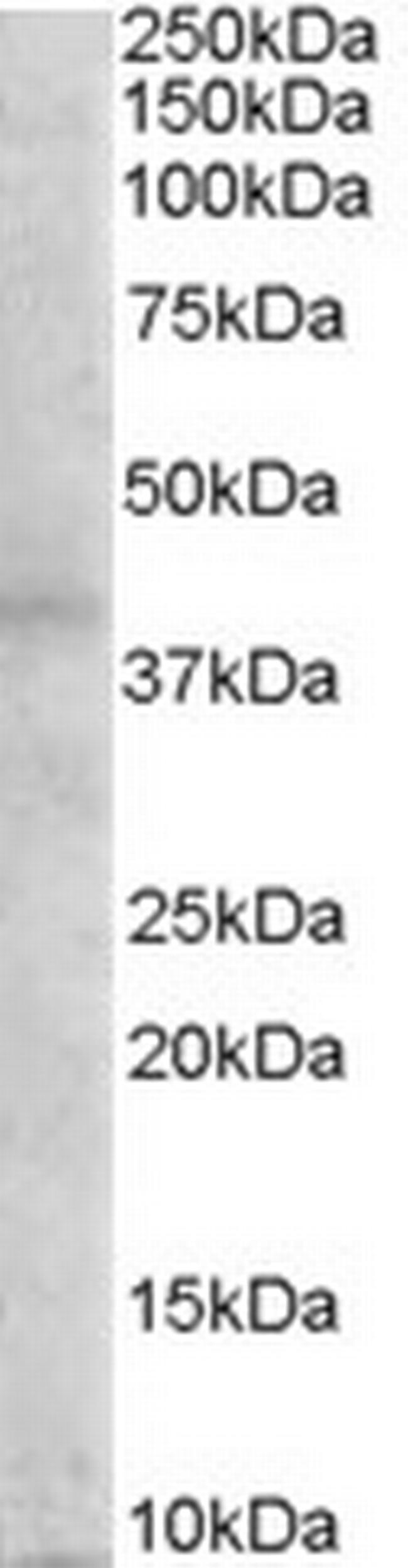 MC3R Antibody in Western Blot (WB)