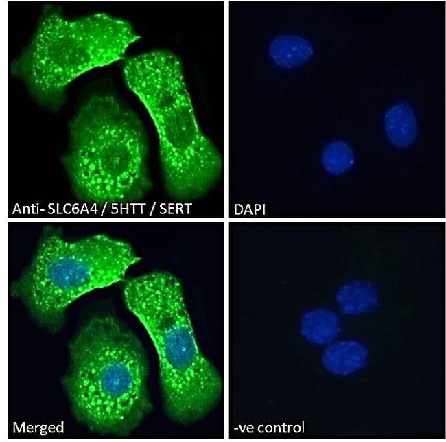 SLC6A4 Antibody in Immunocytochemistry (ICC/IF)