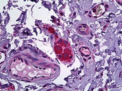 NPY5R Antibody in Immunohistochemistry (Paraffin) (IHC (P))