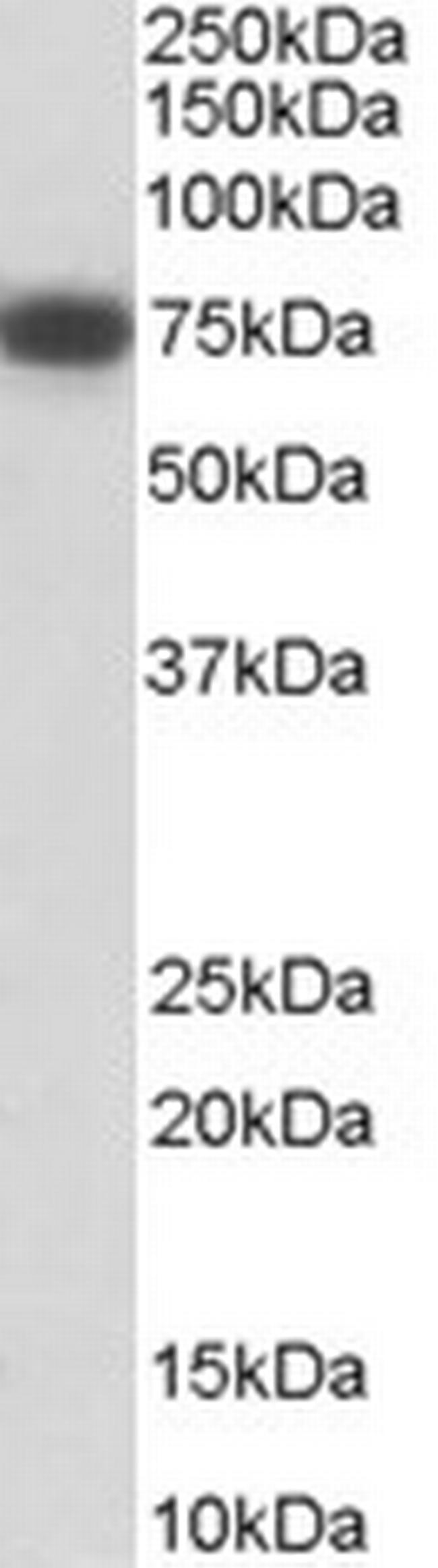 NGFR Antibody in Western Blot (WB)