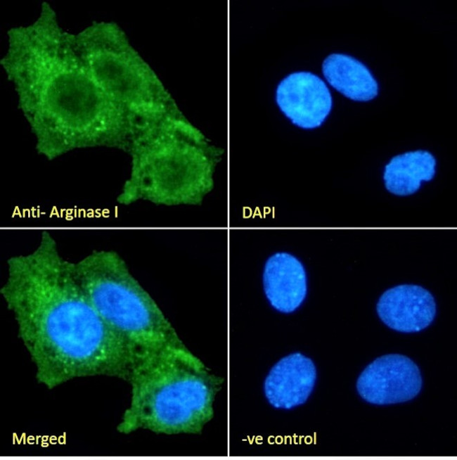 Arginase 1 Antibody in Immunocytochemistry (ICC/IF)