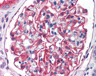 CD249 Antibody in Immunohistochemistry (Paraffin) (IHC (P))