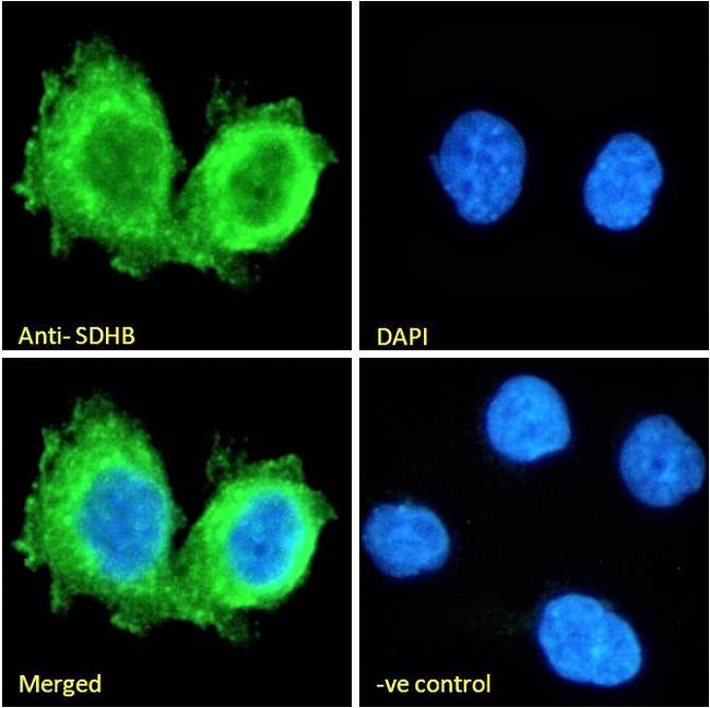 SDHB Antibody in Immunocytochemistry (ICC/IF)