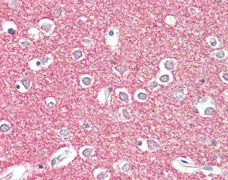 STX1A/STX1B Antibody in Immunohistochemistry (Paraffin) (IHC (P))