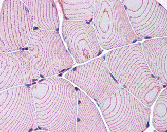 LDB3 Antibody in Immunohistochemistry (Paraffin) (IHC (P))