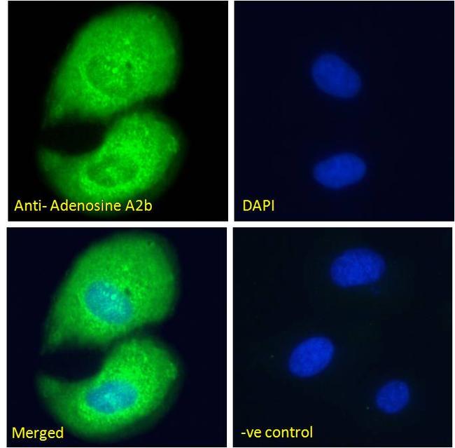 ADORA2B Antibody in Immunocytochemistry (ICC/IF)