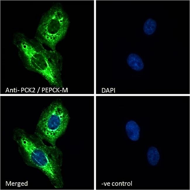 PCK2 Antibody in Immunocytochemistry (ICC/IF)