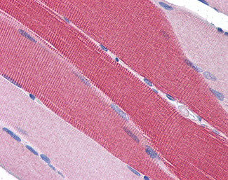 PDE4D Antibody in Immunohistochemistry (Paraffin) (IHC (P))